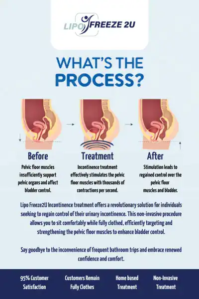 Diagram of how incontinence treatment Mansfield works.