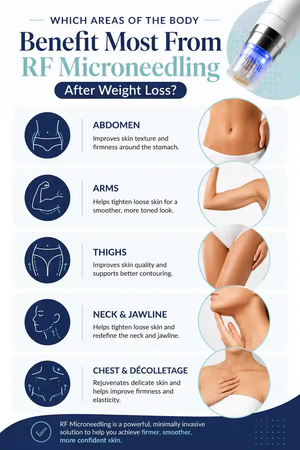 Which Areas of the Body Benefit Most From RF Microneedling After Weight Loss Mansfield
